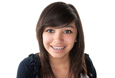 Dental Braces